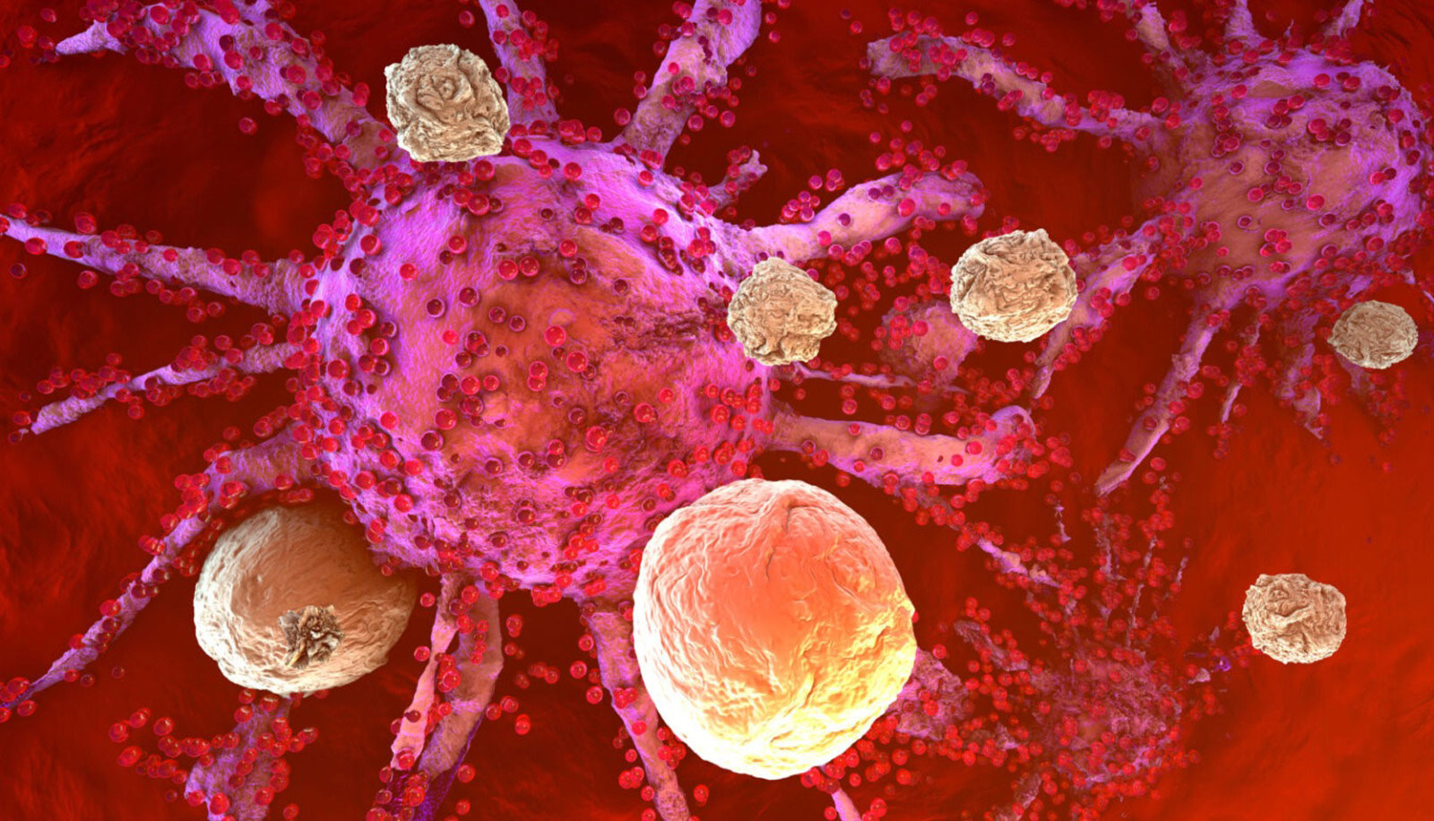 BREAST CANCER AND THE IMMUNE SYSTEM